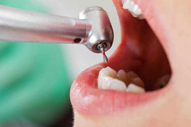 Best Root Canal Emergency Dentist  in Norwood, OK